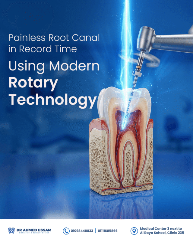 Painless Root Canal