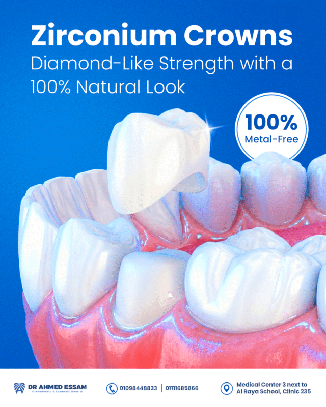 Zirconium Crowns (1)